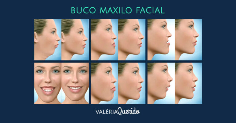 Cirurgia e Traumatologia Buco Maxilo Facial – Odonto Laser Care